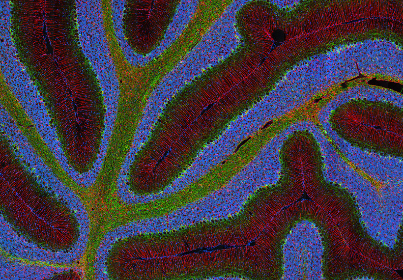 Блог - Конкурс микрофотографии Nikon Small World 2015 Конкурс микрофотографии Nikon Small World 2015