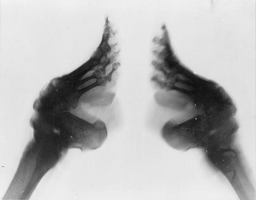 Блог - 31 немыслимая фотография «лотосовых ножек» китайских женщин 31 немыслимая фотография «лотосовых ножек» китайских женщин