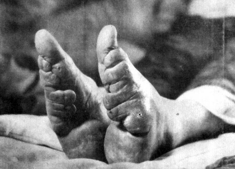Блог - 31 немыслимая фотография «лотосовых ножек» китайских женщин 31 немыслимая фотография «лотосовых ножек» китайских женщин