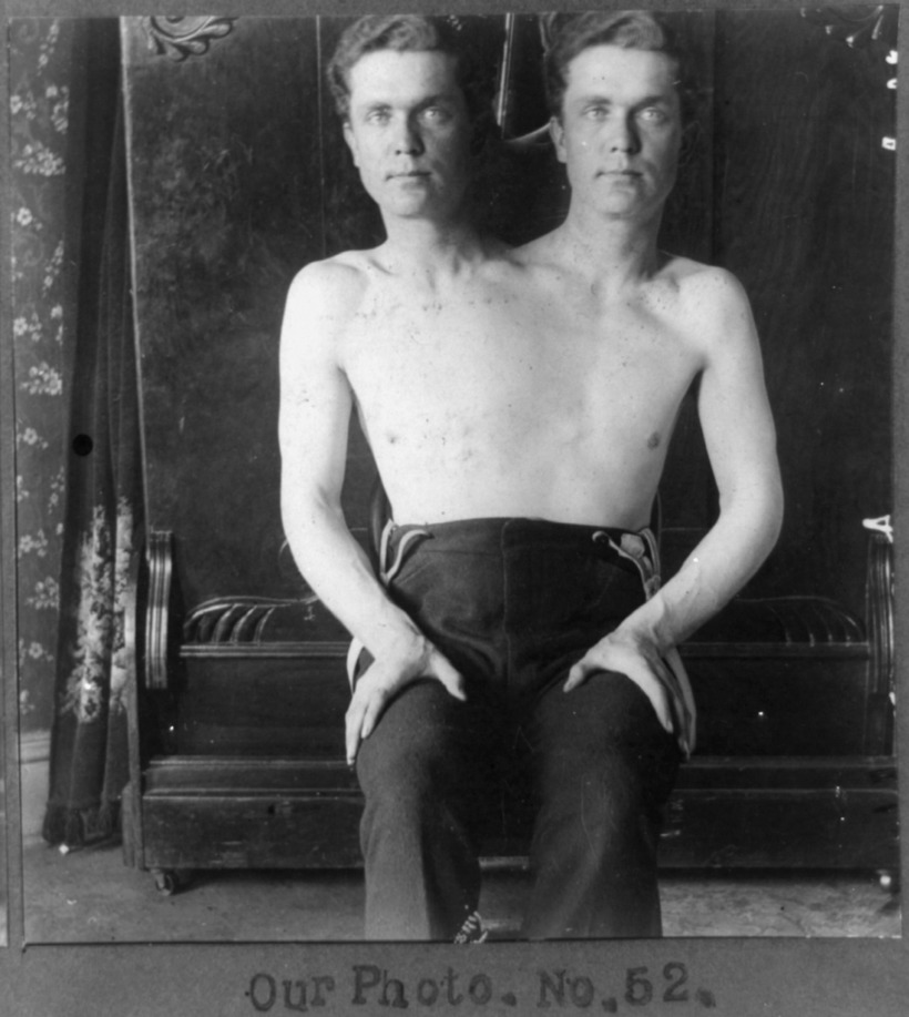 Блог - 15 жутких фотографий артистов цирка прошлых веков 15 жутких фотографий артистов цирка прошлых веков