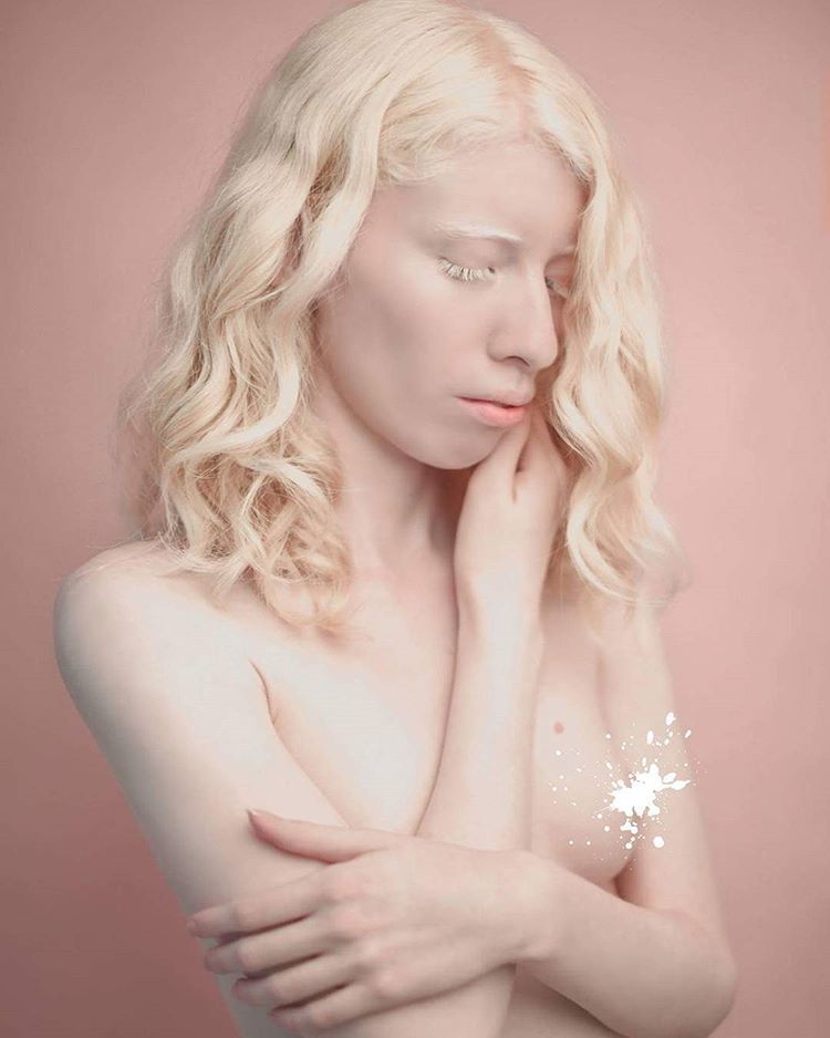 Сегодня мы хотим вам показать, как выглядят люди-альбиносы, принадлежащие к...