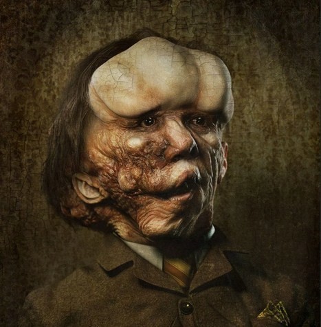 Джозеф Меррик