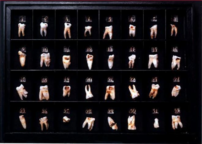 Коллекция зубов, удаленных лично императором