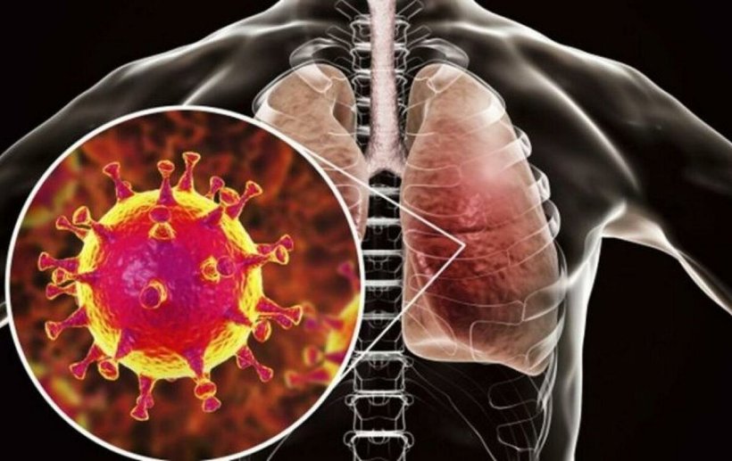 Блог - Чем коронавирус отличается от гриппа Чем коронавирус отличается от гриппа