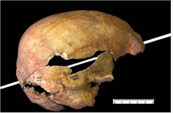 На черепе видны входные отверстия