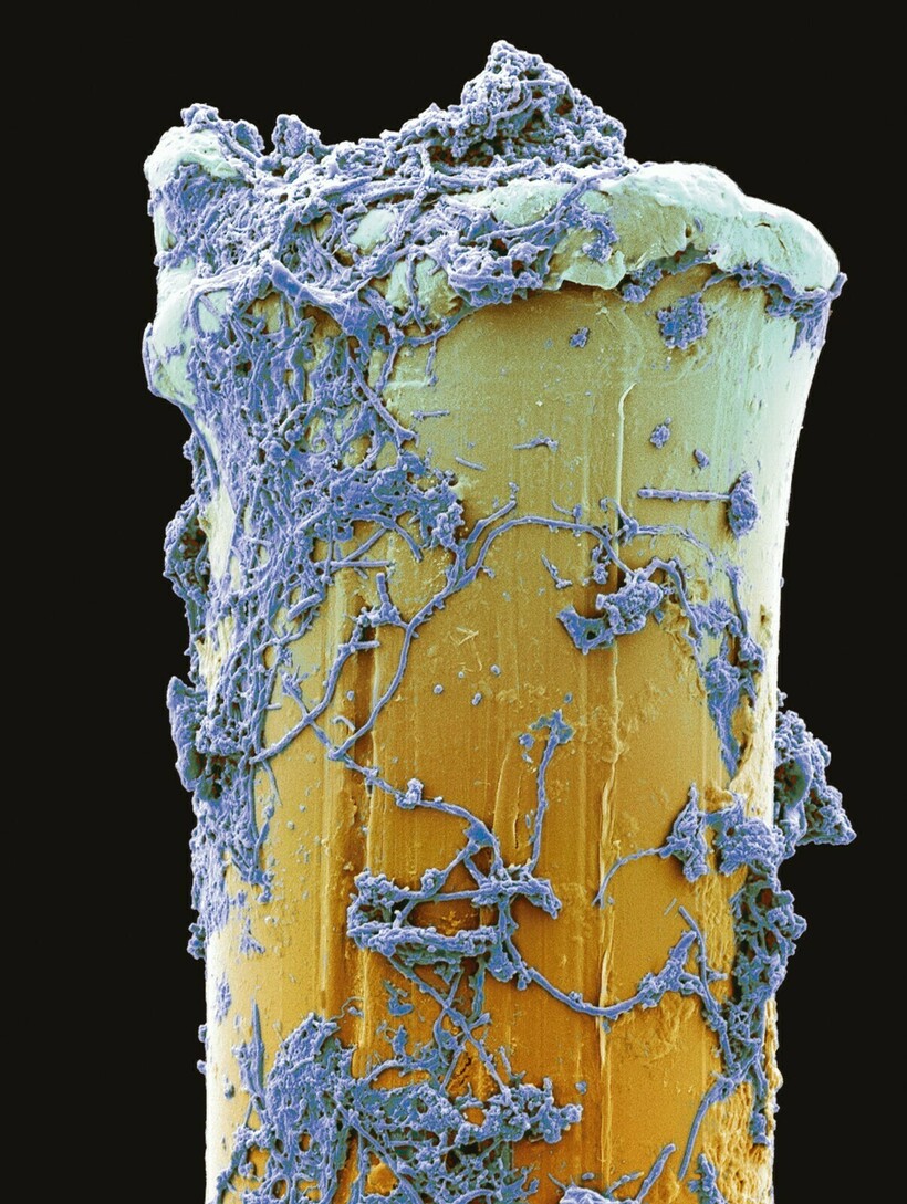 Блог - 17 микрофотографий, которые покажут с новой стороны мир, что кроется у нас под носом 17 микрофотографий, которые покажут с новой стороны мир, что кроется у нас под носом